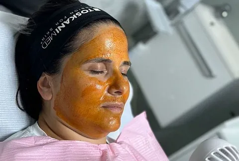 tratamiento facial