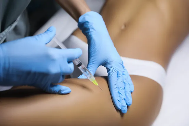 mesoterapia